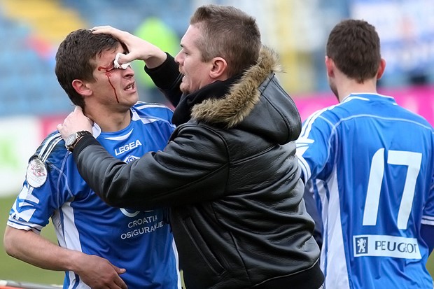 Varteks i Međimurje bez licence